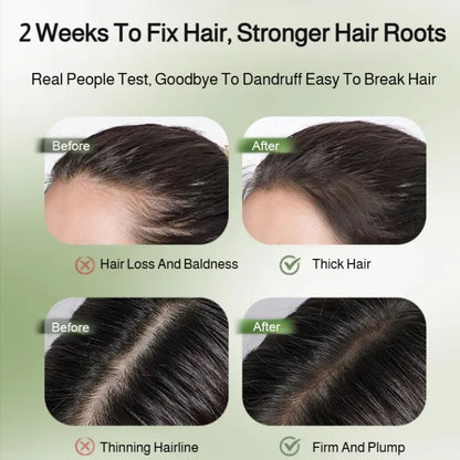 Platycladus Orientalis Usman Shampoo Soap ( BUY 1 GET 1 FREE )