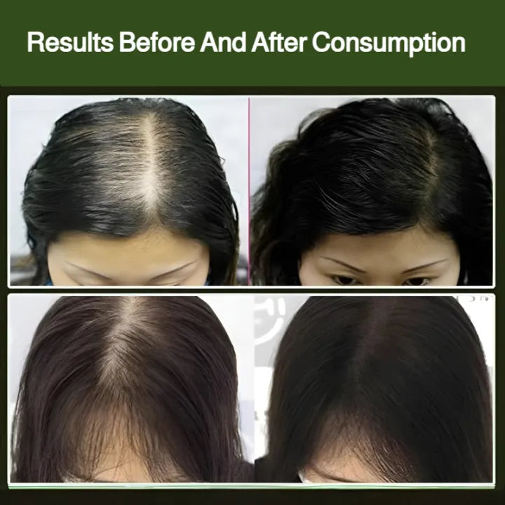 Platycladus Orientalis Usman Shampoo Soap ( BUY 1 GET 1 FREE )