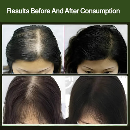 Platycladus Orientalis Usman Shampoo Soap ( BUY 1 GET 1 FREE )