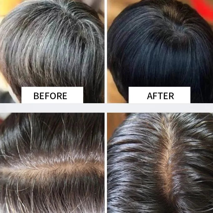 DORISNA Polygonum Essence Hair Shampoo Soap ( BUY 1 GET 1 FREE )