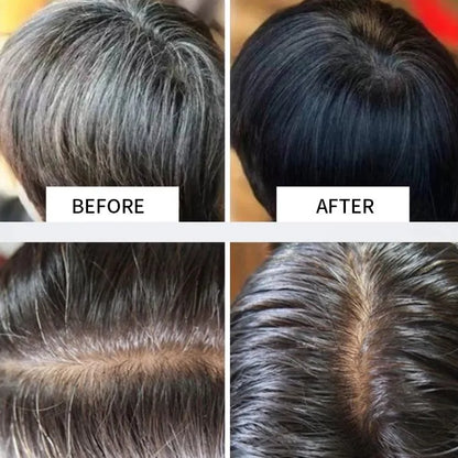 DORISNA Polygonum Essence Hair Shampoo Soap ( BUY 1 GET 1 FREE )