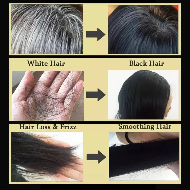 🌿🧼 EELHOE™ Polygonum Multiflorum Soap ( BUY 1 GET 1 FREE )