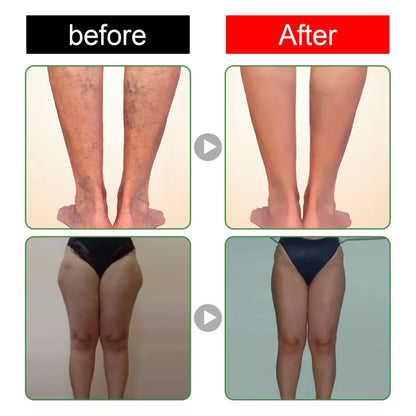 South Moon Deep Cleansing Herbal Foot Pads ( BUY 1 GET 1 FREE )