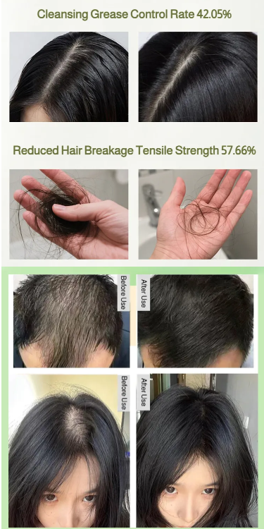 Platycladus Orientalis Usman Shampoo Soap ( BUY 1 GET 1 FREE )