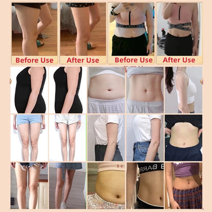 LYDIMOON Slimming belly button patch ( BUY 1 GET 1 FREE )